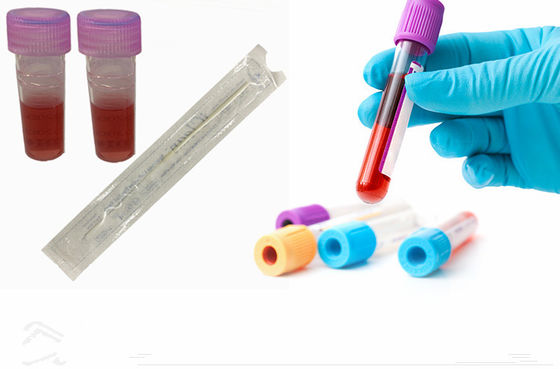 강관과 나일론 섬유 불모 수송 면봉을 샘플링하기 위한 집단 DNA 구강 면봉